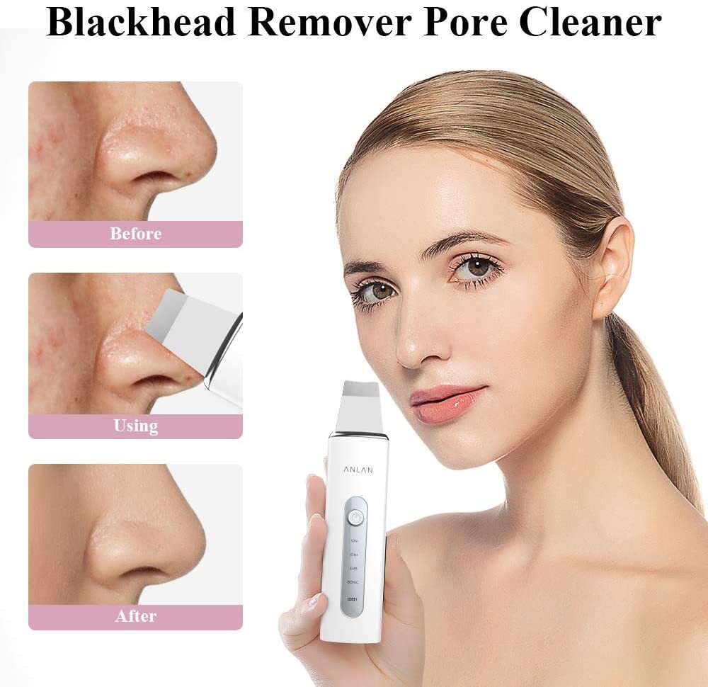 Ion Blackhead Scrubber for cleaning deep pores and skin rejuvenation.