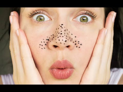 How to remove blackheads from the face easily?
