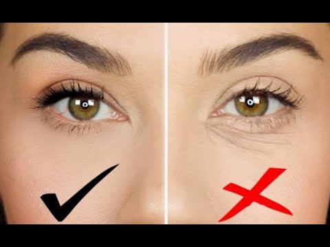 How to remove bags under the eyes in only 1 natural way?